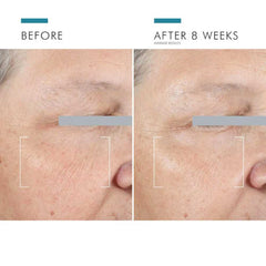 SkinCeuticals AGE Advanced Eye shop at Exclusive Beauty