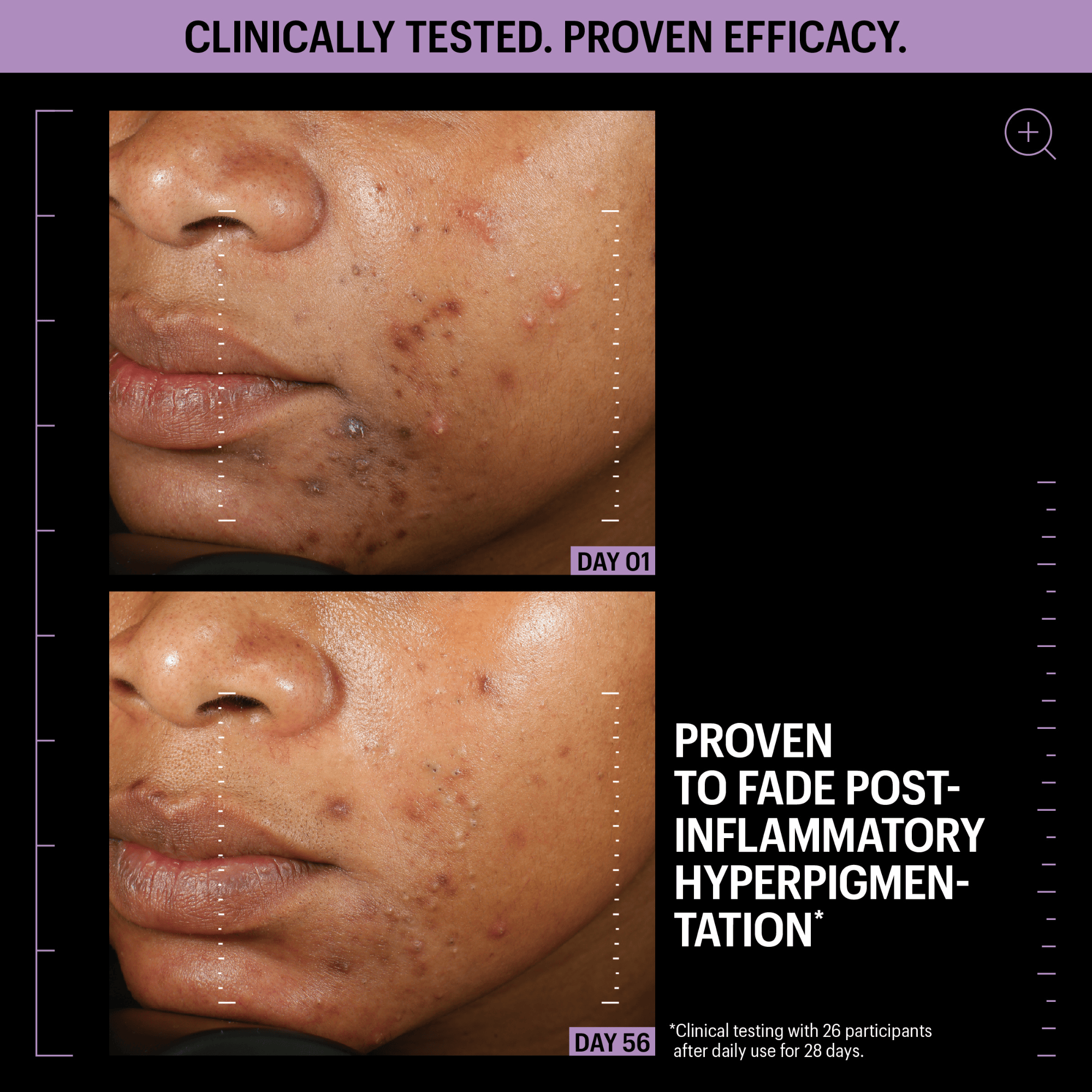 Allies of Skin Azelaic and Kojic Advanced Clarifying Serum