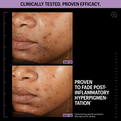 Allies of Skin Azelaic and Kojic Advanced Clarifying Serum