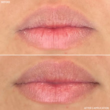 Carregar imagem no visualizador da Galeria, Rescue MD Restorative Lip Treatment Results Shop At Exclusive Beauty
