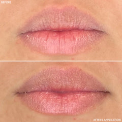 Rescue MD Restorative Lip Treatment Results Shop At Exclusive Beauty