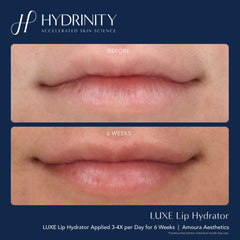 Hydrinity LUXE Lip Hydrator