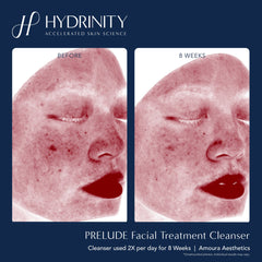 Hydrinity Prelude Cleanser Before and After