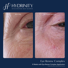 Before Ad After Hydrinity Eye Renew Complex