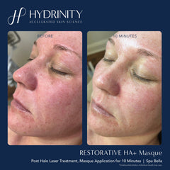 Hydrinity Restorative HA+ Masque