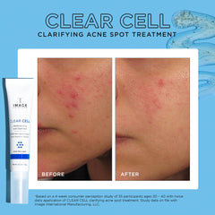 Image Skincare Clear Cell Clarifying Acne Spot Treatment Results Shop At Exclusive Beauty