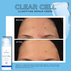 Image Skincare Clear Cell Clarifying Repair Creme Results Shop At Exclusive Beauty
