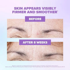 ClarityRx-Better-With-Age-Moisturizer-Before-and-After