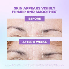 ClarityRx-Better-With-Age-Renewing-Bakuchiol-Serum-Before&After-8weeks