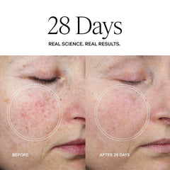 Exoceuticals Exo Plus Anti-Aging Cream