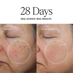 Exoceuticals Exo Face Perfection Moisturizer