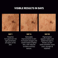 Before-and-after skin treatment results showing visible improvements over 28 days.