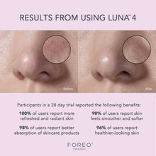 Carregar imagem no visualizador da Galeria, FOREO LUNA 4 Sensitive Skin shop at Exclusive Beauty
