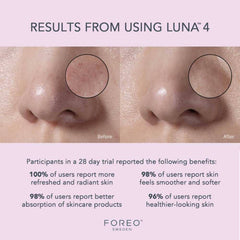 FOREO LUNA 4 Sensitive Skin shop at Exclusive Beauty