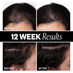 IGK Sponsored Hair Density Scalp Treatment