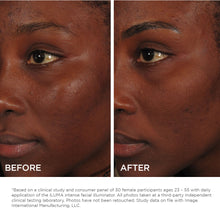 Cargar imagen en el visor de galería, Image Skincare Iluma Intense Facial Illuminator Results Shop At Exclusive Beauty
