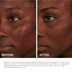 Image Skincare Iluma Intense Facial Illuminator Results Shop At Exclusive Beauty