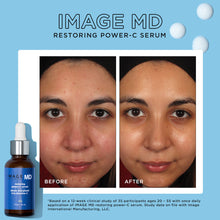Cargar imagen en el visor de galería, Image MD Restoring Power C Serum Results Discover At Exclusive Beauty
