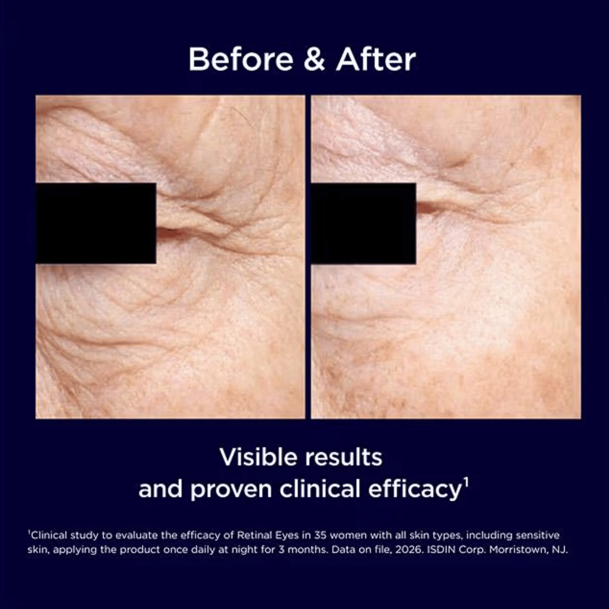 ISDIN Isdinceutics Retinal Eyes anti-aging eye serum for under-eye wrinkles and dark circles. Available at Exclusive Beauty Club.