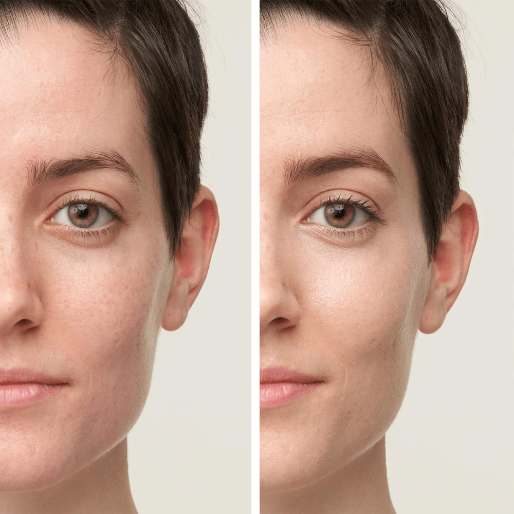Jane Iredale Active Light Concealer Before and After Shop At Exclusive Beauty 4