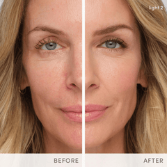 Jane Iredale HydroPure Tinted Serum Before/After 1 Shop At Exclusive Beauty