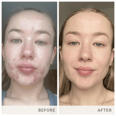 Jane Iredale Skin Accumax® 14 Week Reset Box