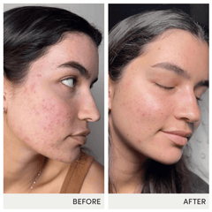 Jane Iredale Skin Accumax® Supplements