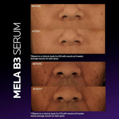 La Roche-Posay Mela B3 Dark Spot Serum