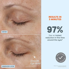 NuFACE FIX MicroWand Microcurrent Device for Eyes, Lips & Lines