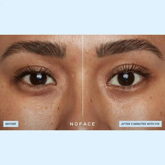 Before and after using NuFACE Hydra-Gel Power Patches showing reduced puffiness and smoother under-eyes