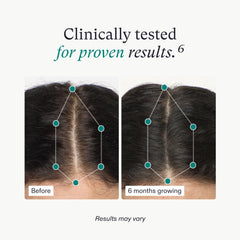 Nutrafol Women's Hair Growth Nutraceutical