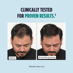 Nutrafol Men Hair Growth Nutraceutical