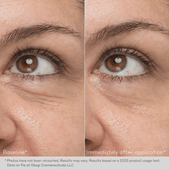 Obagi Daily Hydro-Drops® Rejuvenating Eye Gel Cream Results 2 Shop Obagi at Exclusive Beauty