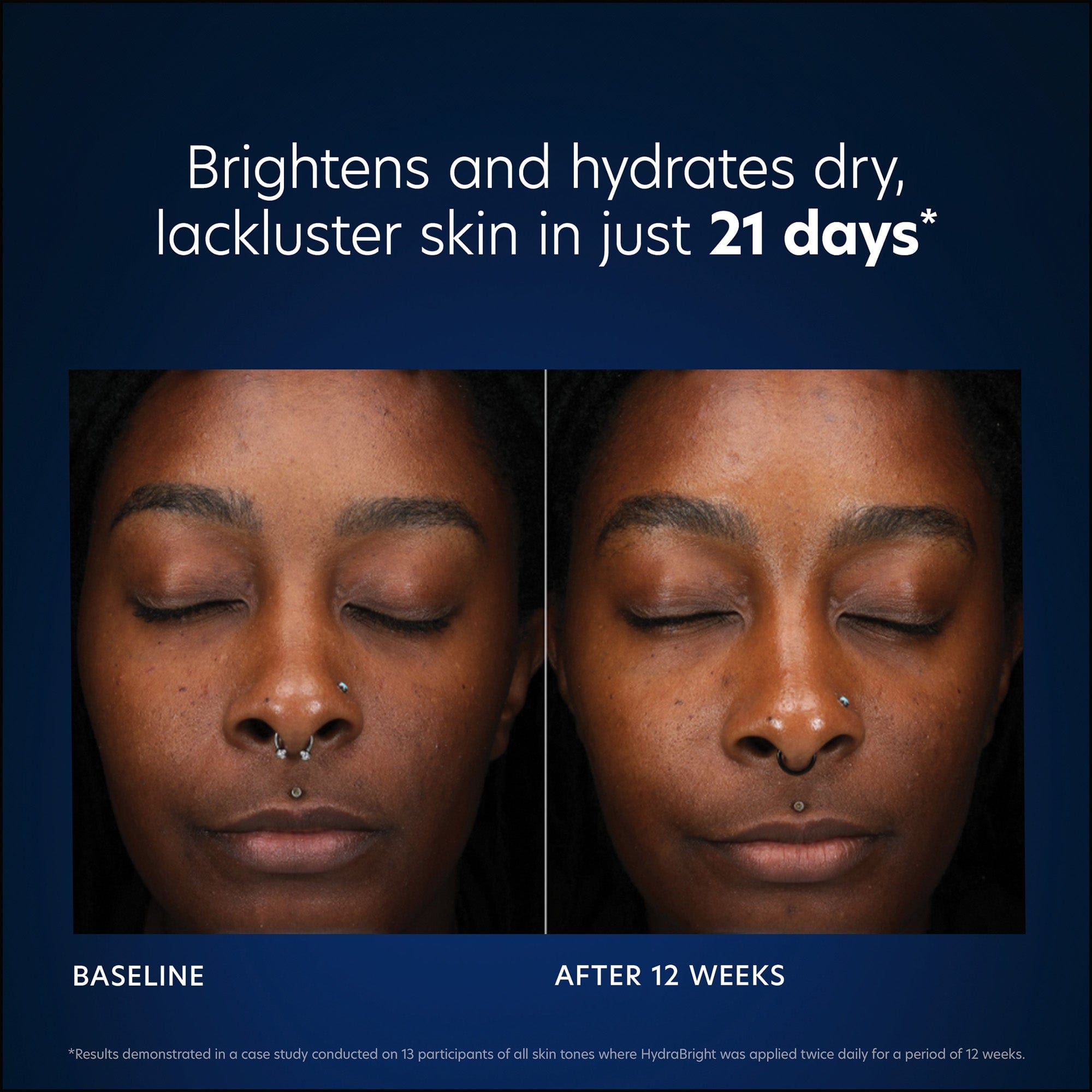 PCASkin Hydrabright Intensive Brightening Hydration Results Shop At Exclusive Beauty