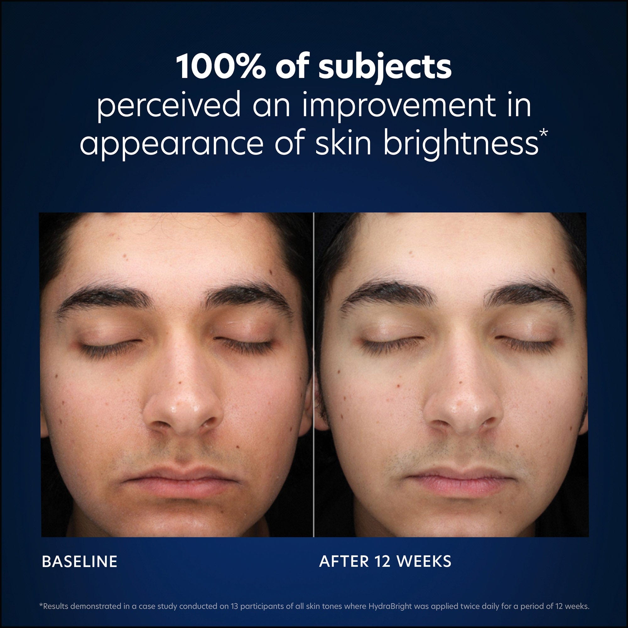 PCASkin Hydrabright Intensive Brightening Hydration Brightness Results Shop At Exclusive Beauty