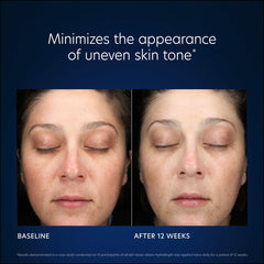 PCASkin Hydrabright Intensive Brightening Hydration Skin Tone Results Shop At Exclusive Beauty