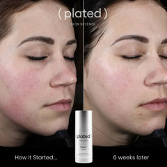 Plated Skin Science DAILY Serum Shop at Exclusive Beauty Club Anti-aging serum