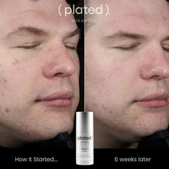 Plated Skin Science DAILY Serum Shop at Exclusive Beauty Club Anti-aging serum
