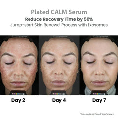 Plated Skin Science CALM Post-Procedure Serum Shop Post Procedure Serum Exclusive Beauty Club