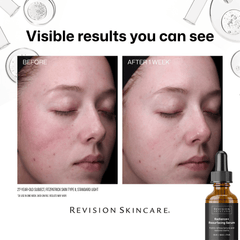 Shop Revision Skincare Radiance+ Resurfacing Serum at Exclusive Beauty Club Face Serum