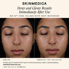 SkinMedica HA5 Hydra Collagen Water Burst Moisturizer