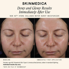 SkinMedica HA5 Hydra Collagen Water Burst Moisturizer