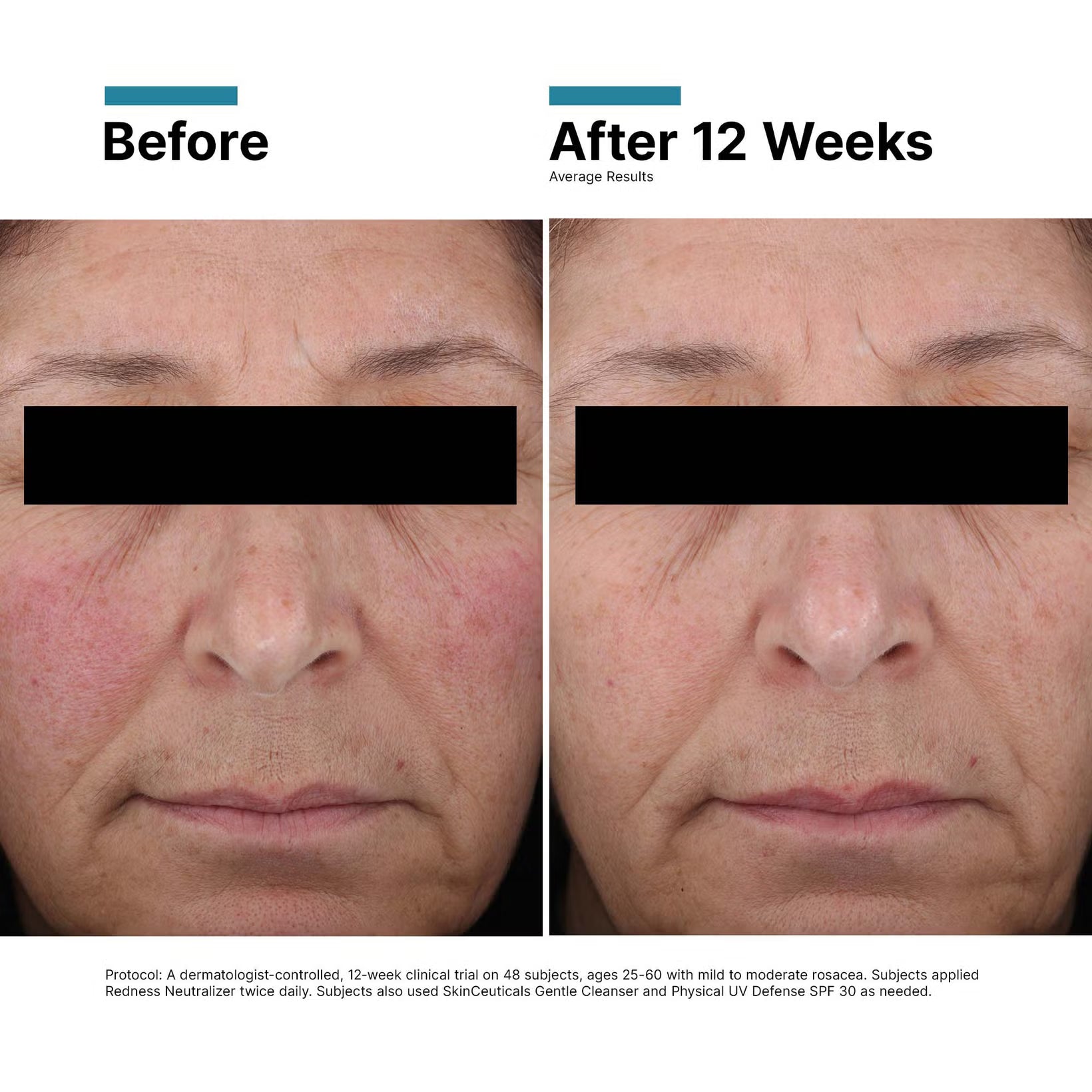 SkinCeuticals Redness Neutralizer SkinCeuticals 1.67 fl. oz. Shop at Exclusive Beauty Club