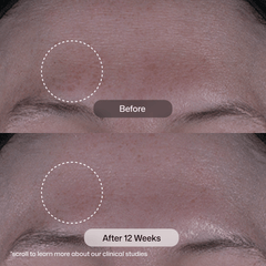 Revision Skincare Tone+ Correcting Pads