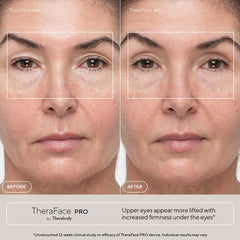 TheraBody TheraFace Pro Black