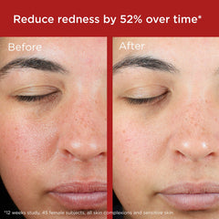 EltaMD UV Skin Recovery Broad Spectrum SPF 50 Face Sunscreen