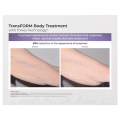 ALASTIN Skincare TransFORM Body Treatment before and after showing 63% less crepey arm skin in 8 weeks