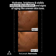 Allies of Skin Mandelic Night Serum before and after showing reduced discoloration at night 42
