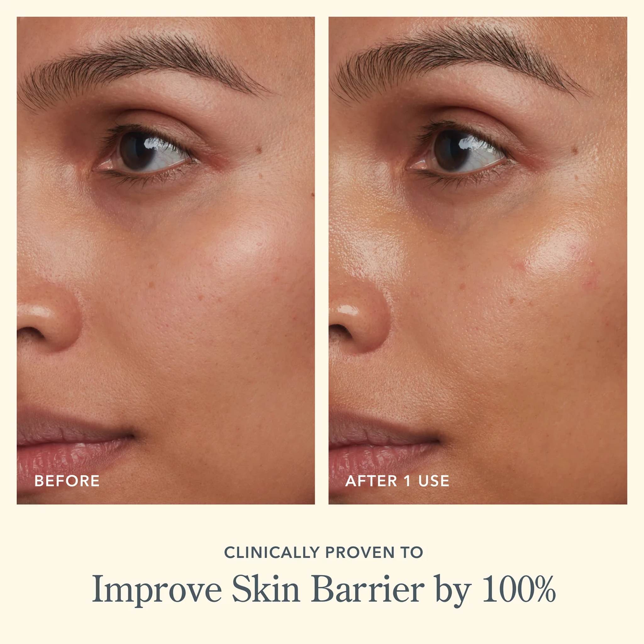 Before and after photos showing improved skin barrier after one use of Bloom Cream