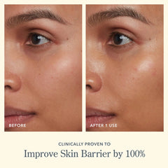Before and after photos showing improved skin barrier after one use of Bloom Cream